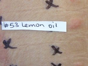 Pruebas de parche positivas para el aceite de limón.