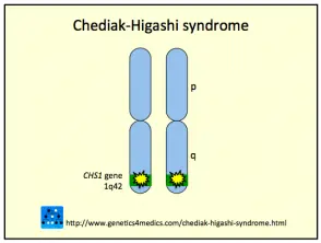 Síndrome de chediak-higashi__protectwyjqcm90zwn0il0_focusfillwzi5ncwymjisingildfd-7365485-1814492