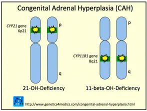 congenital-adrenal-hyperplasia-cah__protectwyjqcm90zwn0il0_focusfillwzi5ncwymjisingildjd-2052955-3737106