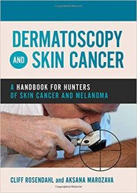 dermatoscopy-skin-cancer__scalewidthwze5of0-5853503-2956488