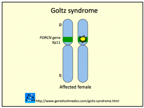 focal-dermal-hypoplasia__protectwyjqcm90zwn0il0_focusfillwzi5ncwymjisingildfd-8687204-5989889