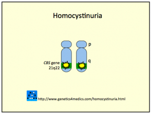 homocystinurie2__protectwyjqcm90zwn0il0_focusfillwzi5ncwymjisingildfd-6331884-4623464