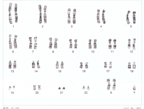 cromossomos humanosxxy01__protectwyjqcm90zwn0il0_focusfillwzi5ncwymjisinkildnd-7590564-1562942