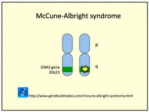 mccune-albright-syndrome__protectwyjqcm90zwn0il0_focusfillwzi5ncwymjisingildfd-7384939-2368441