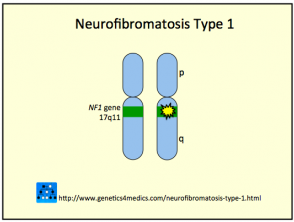 neurofibromatosis-type-1__protectwyjqcm90zwn0il0_focusfillwzi5ncwymjisingildjd-9510949-8783088