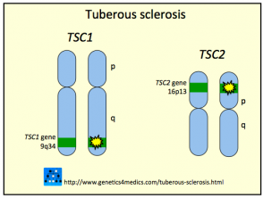 tuberous-sclerosis__protectwyjqcm90zwn0il0_focusfillwzi5ncwymjisingildfd-8554560-9359071