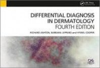 differential-diagnosis-dermatology-richard-ashton__scalewidthwze5of0-6743542-9606291