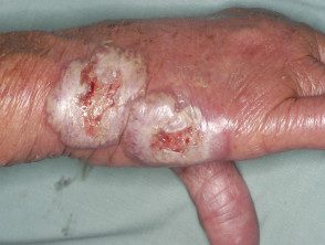 figure-8-feverrash__protectwyjqcm90zwn0il0_focusfillwzi5ncwymjisingilde5xq-7158962-6514145