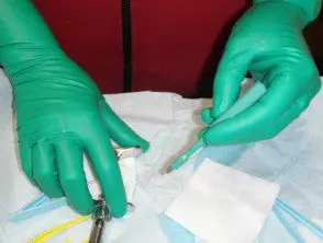 Guantes verdes en cirugía