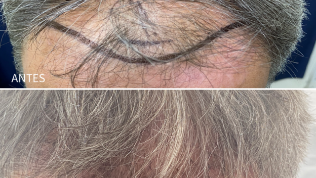 capillary01-7247482
