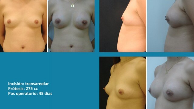 galeria-protesis-1512-03-1-4869069