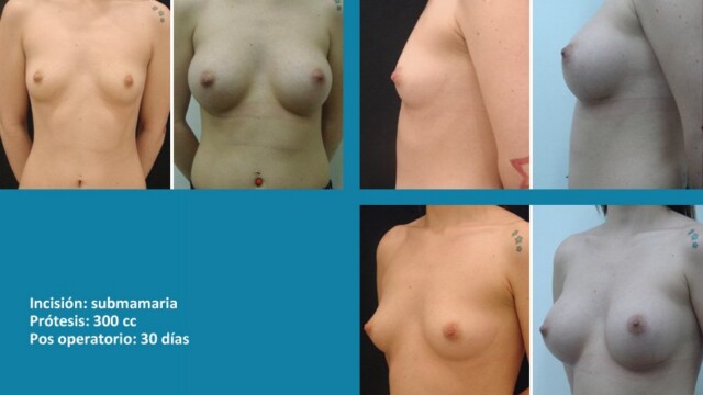 galeria-protesis-1512-06-1-8897202