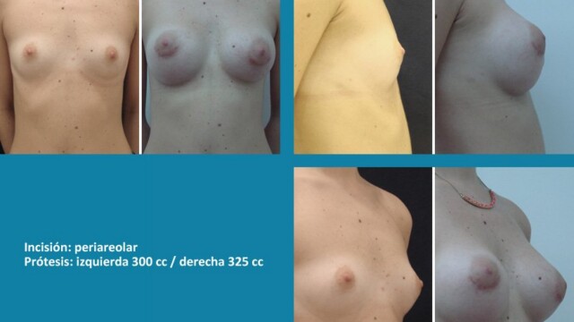 galeria-protesis-1512-08-1-8920777